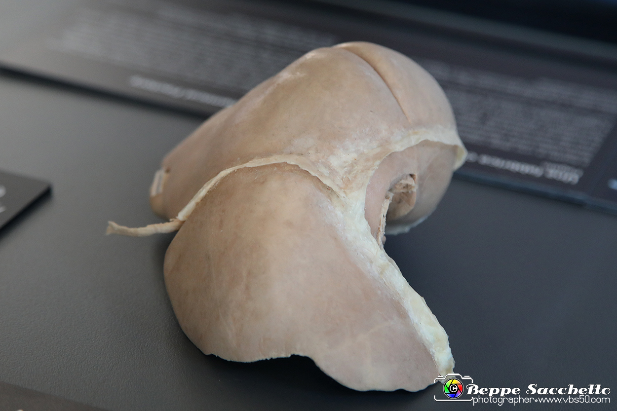 VBS_2726 - Fegato - Mostra Body Worlds.jpg